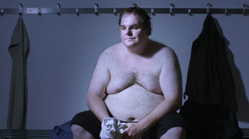 Medier misforstår fedme