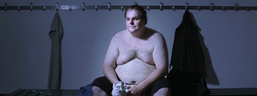 Medier misforstår fedme