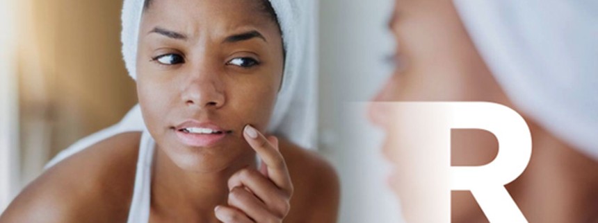 Sådan kommer du akne og akne ar til livs