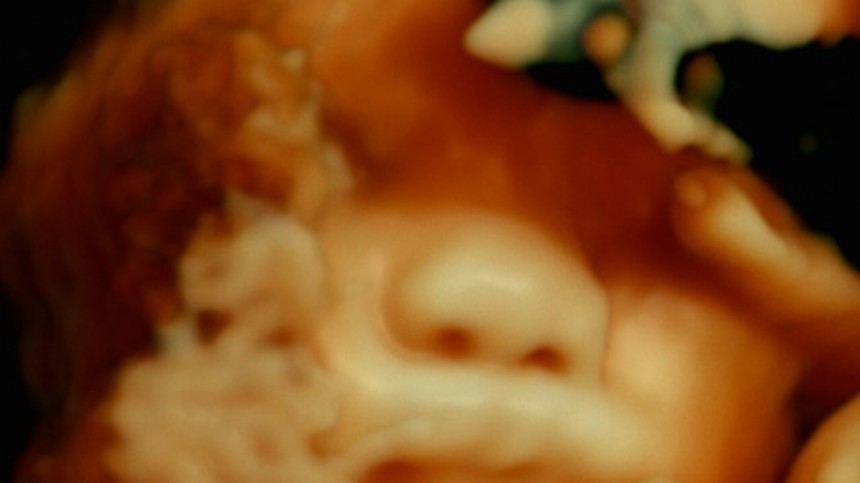 De humani corporis fabrica